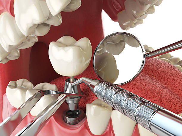Best Weekend Emergency Dentist in Ste Genevieve, MO